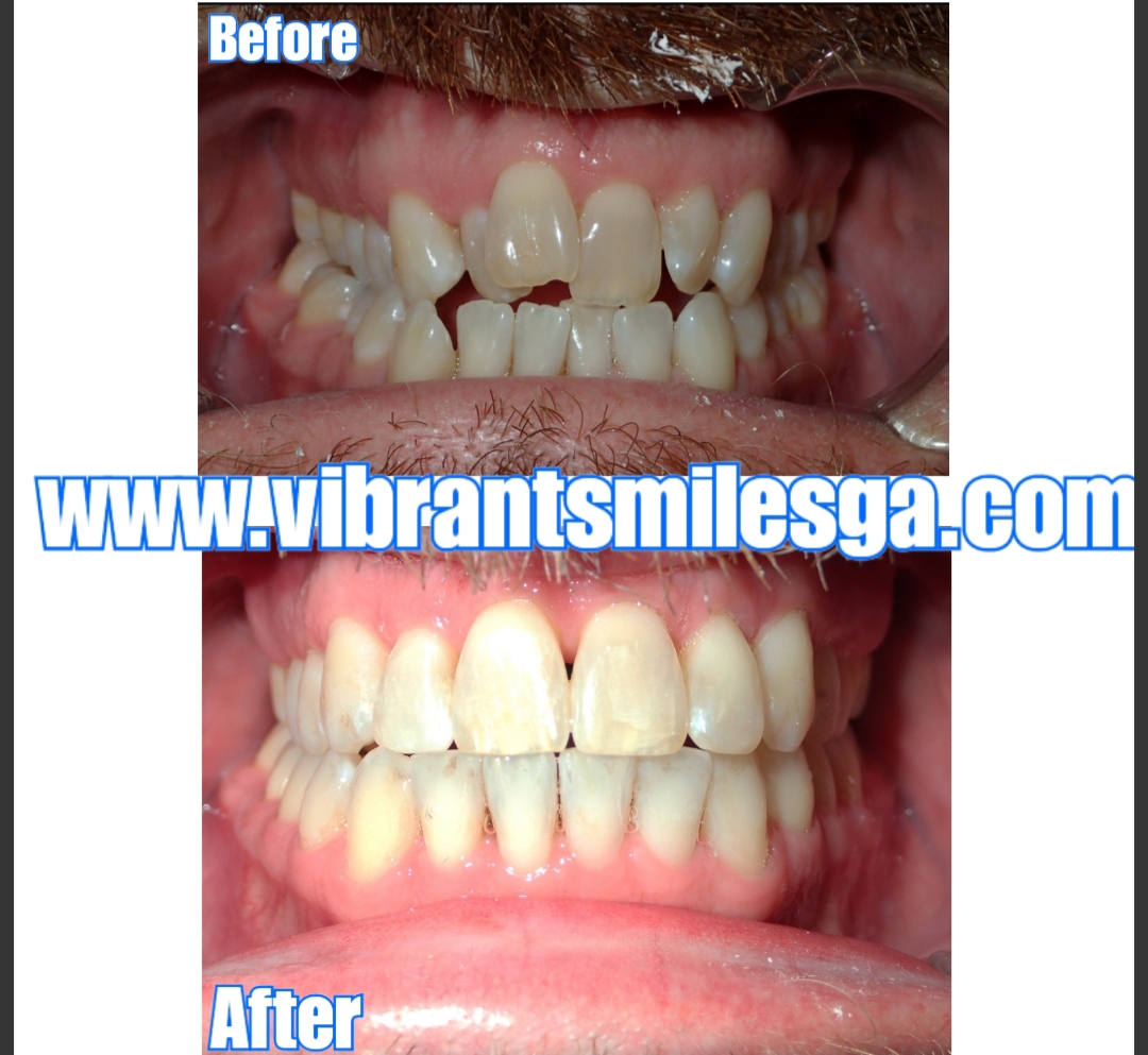 Vibrant Smiles Family and Cosmetic Dentistry Black Owned Dental Practices