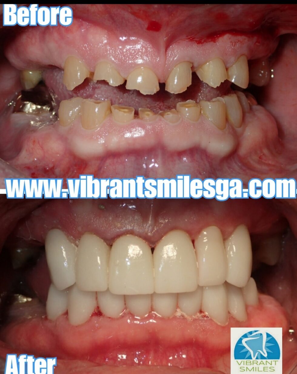 Vibrant Smiles Family and Cosmetic Dentistry Black Owned Dental Practices
