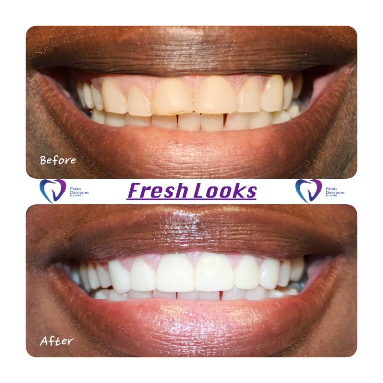 77F417C6 2F1E 4600 84B1 E73E73CDE487 768x768