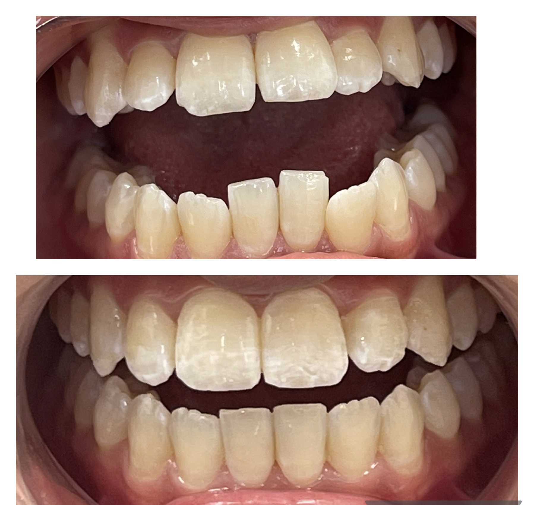 114399AA 8BBF 490F A751 D6DF3A821D8E