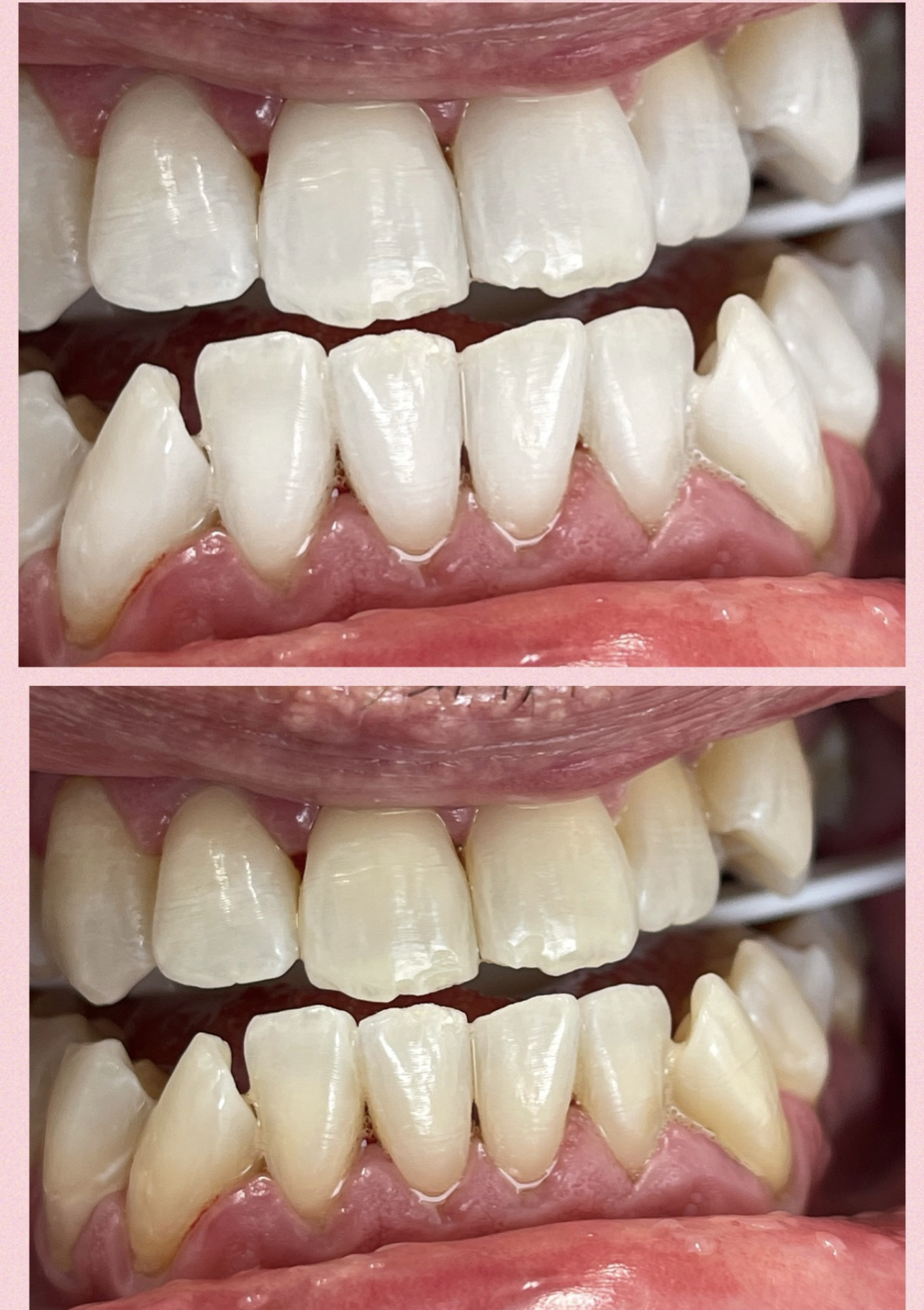 D2D5FF0F 163C 4410 83D4 C4C2E3641475